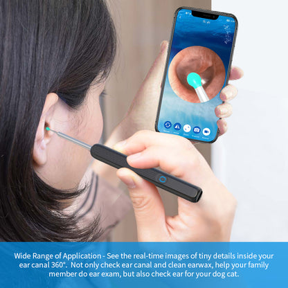 NE3 Ear Wax Removal Otoscope – Wireless Camera Kit