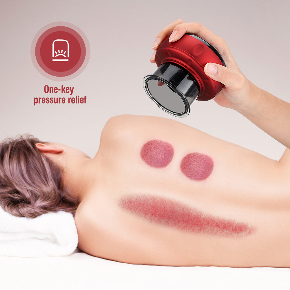 Electric Vacuum Cupping Massager – Anti-Cellulite Therapy