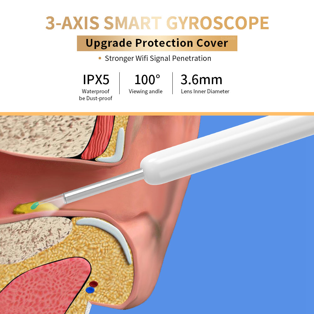 NE3 Ear Wax Removal Otoscope – Wireless Camera Kit