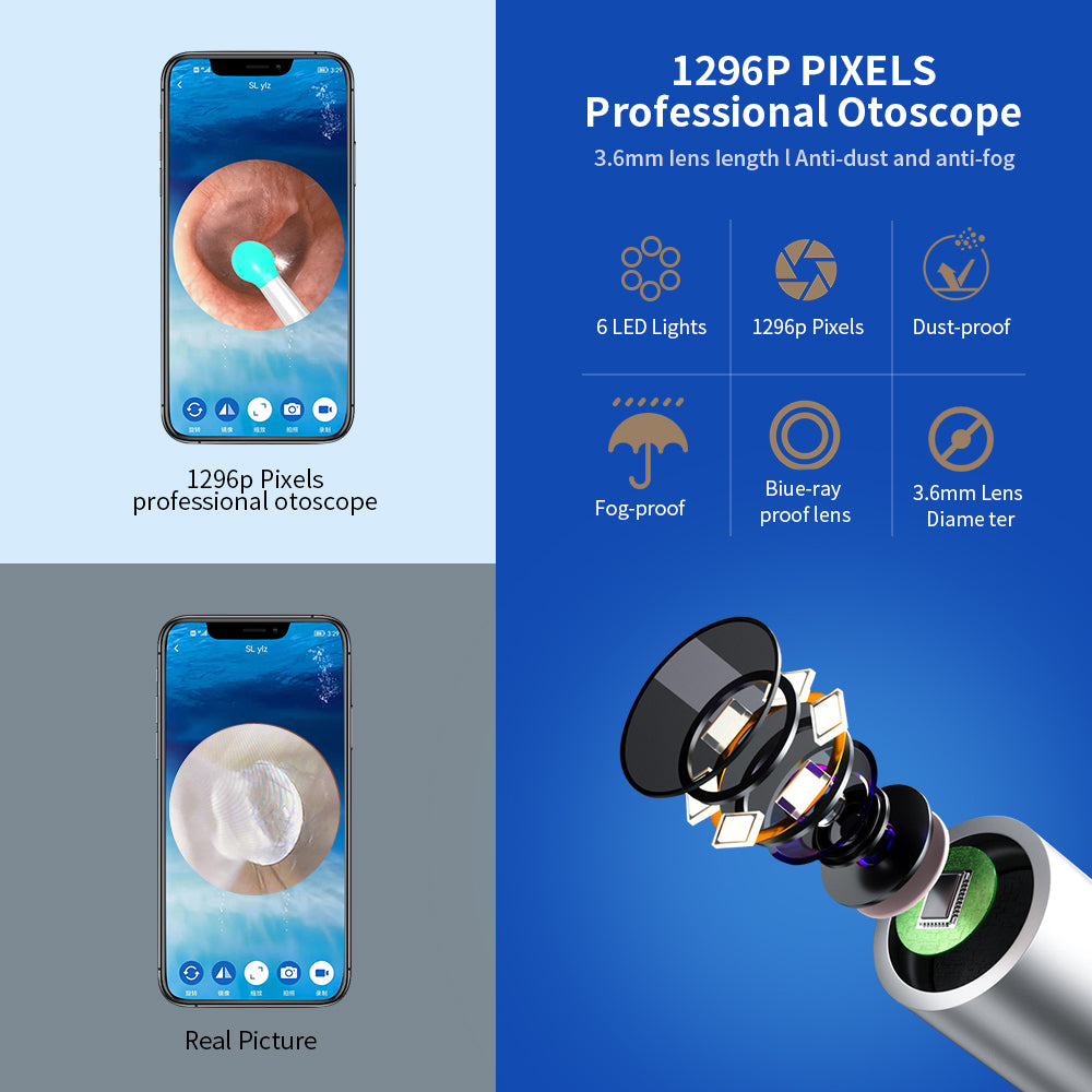 NE3 Ear Wax Removal Otoscope – Wireless Camera Kit